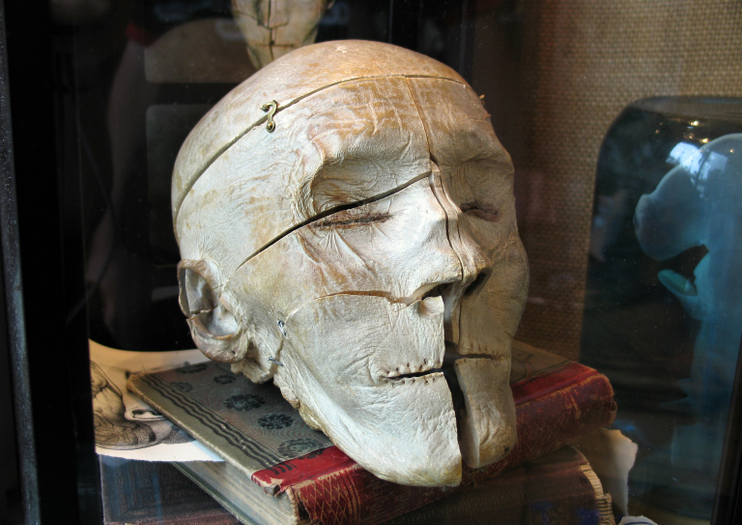 Mütter Museum